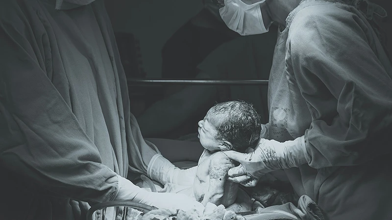 What should you do if your baby has a newborn clavicle fracture?